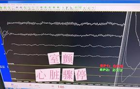 “救命”的心内科被封控了？奉贤这家医院里，两幢楼+两个团队架起生命桥梁