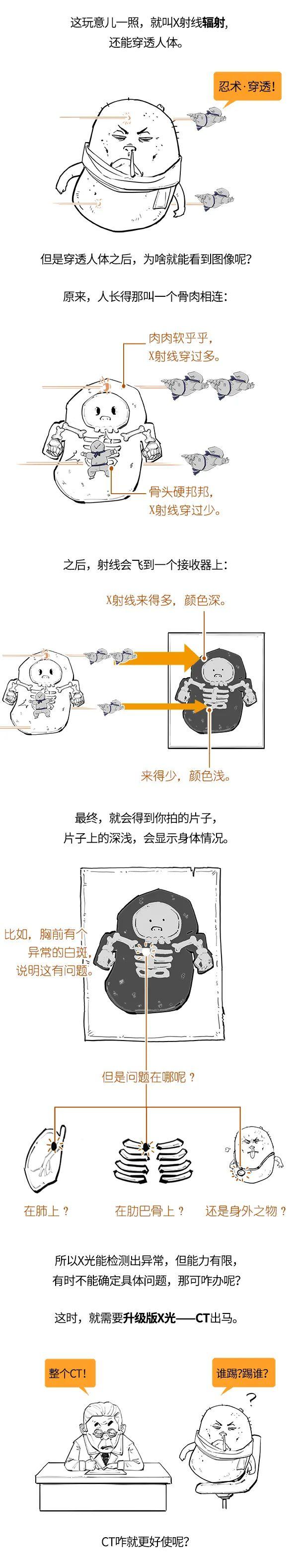 拍X光和做CT有啥不一样？会致癌吗？