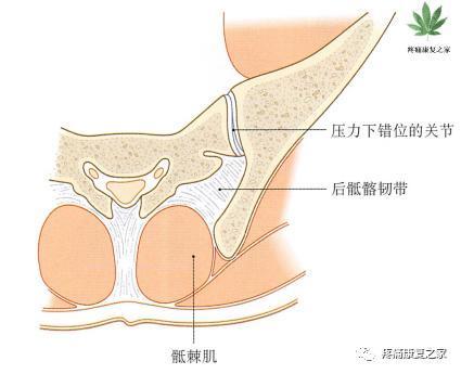 骶髂关节穿刺技巧