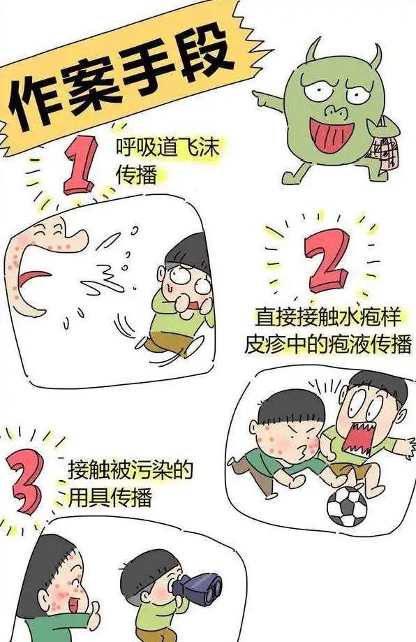 水痘疫苗如何接种？这些“战痘”小妙招需了解→