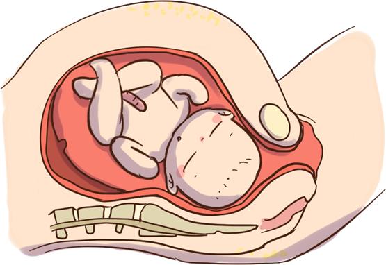 麦澜德观察 | 子宫脱垂是什么 麦特斯磁刺激仪助力女性盆底康复