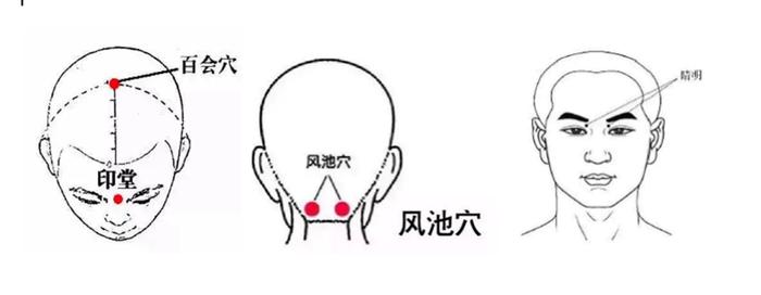 东城中医医院专家、国家名老中医王素梅：治疗儿童抽动症中医有法宝