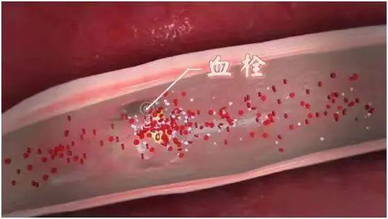 【健康】鸡蛋的又一好处被发现！怎么吃很有讲究