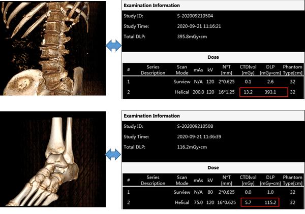 详解CBCT-DR技术原理 西门子医疗与安健科技推出全球两款CBCT-DR