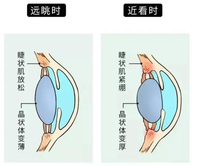 孩子近视就立马去配眼镜？听听松江眼科医生的建议