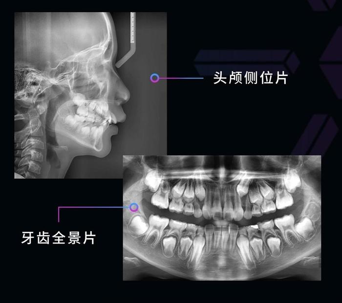 青苗X计划|预约全周期颜面评估，释放X力量