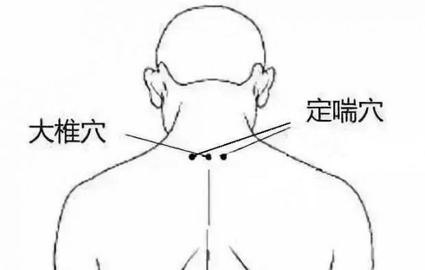 人体上有5个感冒“开关”！空调吹出来的小毛病，刮一刮就好~