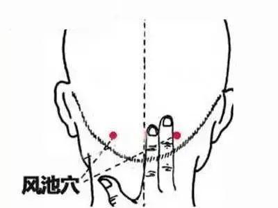 人体上有5个感冒“开关”！空调吹出来的小毛病，刮一刮就好~