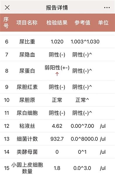 尿常规 检查报告