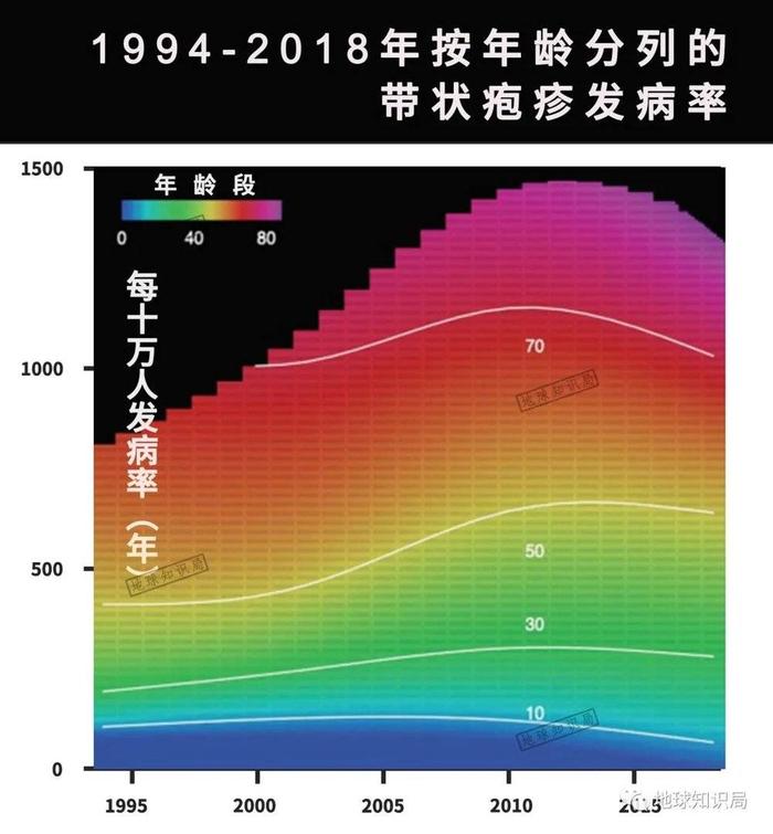 好疼的“蛇缠腰”，可能就潜伏在你体内