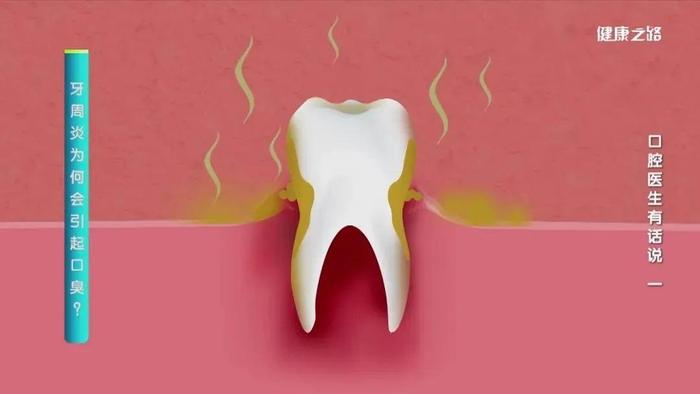 牙齿松动、敏感、牙龈出血……这可能是牙周病，不能拖！