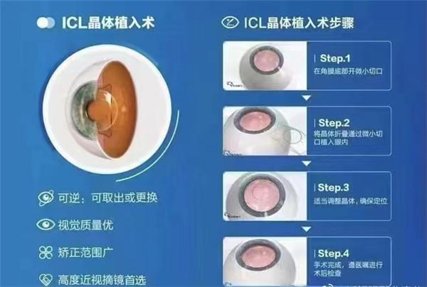 大咖亲诊？畅享自由？超高清视力？合肥瑶海普瑞眼科近视手术帮你统统实现！