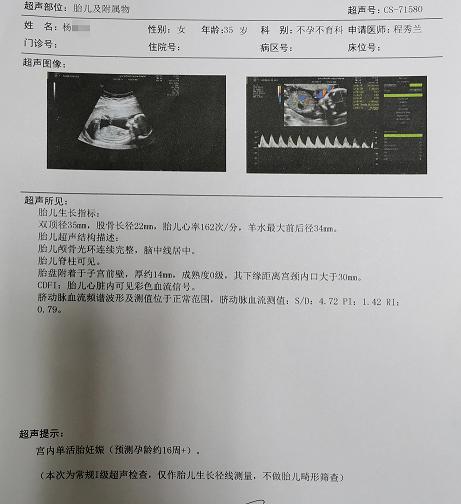 【盐城报喜】宫腔粘连+双侧输卵管堵塞,35岁的她头胎二胎都是在邦德看好怀孕!