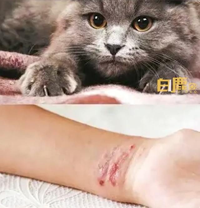 1岁男孩被小猫抓伤，半个月来反复发烧，医生：这是感染了“猫抓病”