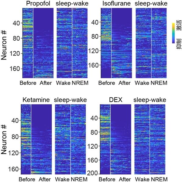 科学家发现全身麻醉对睡眠核心网络的调控规律