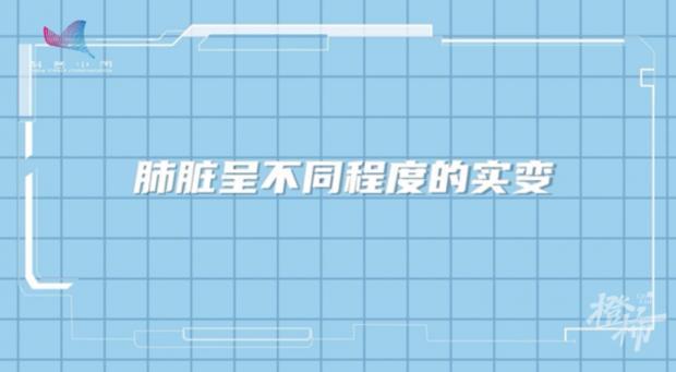 指夹式血氧仪、血氧手表、血氧APP哪个靠谱？医生说了专业建议