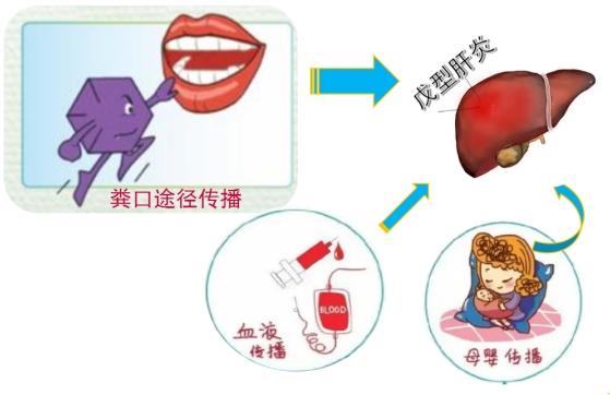 新疆的朋友们注意啦！排行老五的戊肝病毒威力不小 这些误区要纠正