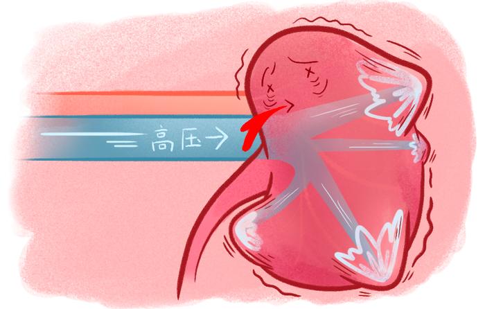 死亡率比肝癌还高的疾病，两类人特别要注意