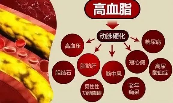 血脂高，百病生，这四种食物一定要少吃