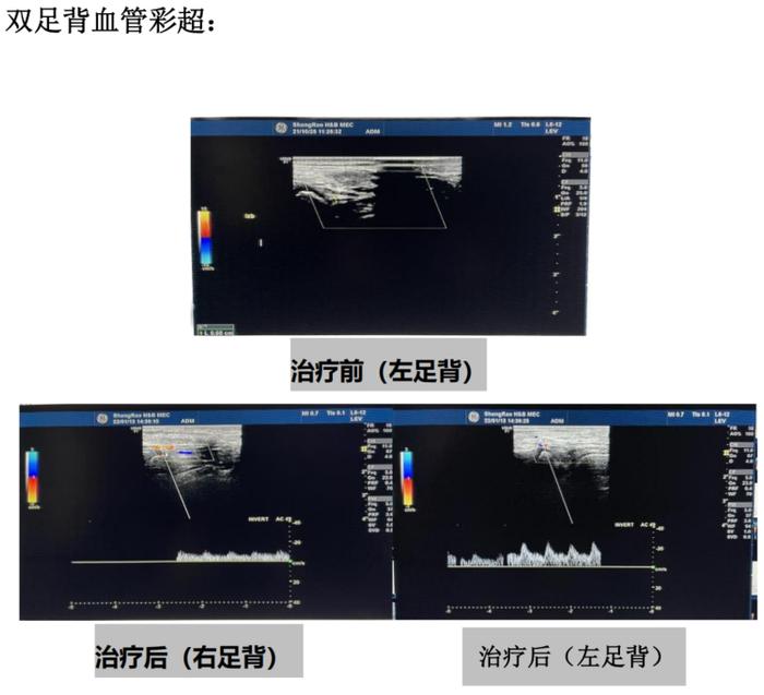 汉氏联合医院间充质干细胞治疗取得重大突破，国际期刊深度报道