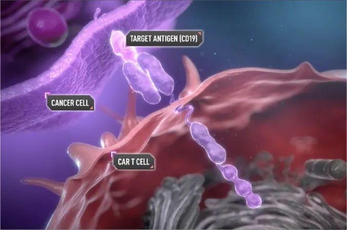 CAR-T 重大利好！英国国家健康与临床优化研究所 (NICE) 批准 NHS 常规使用 CAR-T 治疗弥漫性大B细胞淋巴瘤