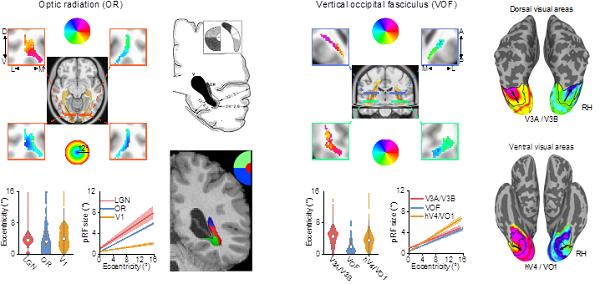 科学家研究揭示视觉白质纤维束的视野功能图谱