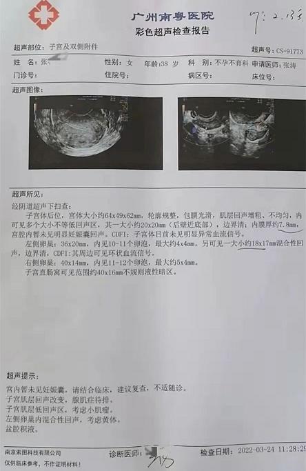 【湖南报喜】38岁高龄结扎10多年复通后,一直怀不上,检查发现输卵管轻度粘连,经南粤治疗成功怀上宝宝