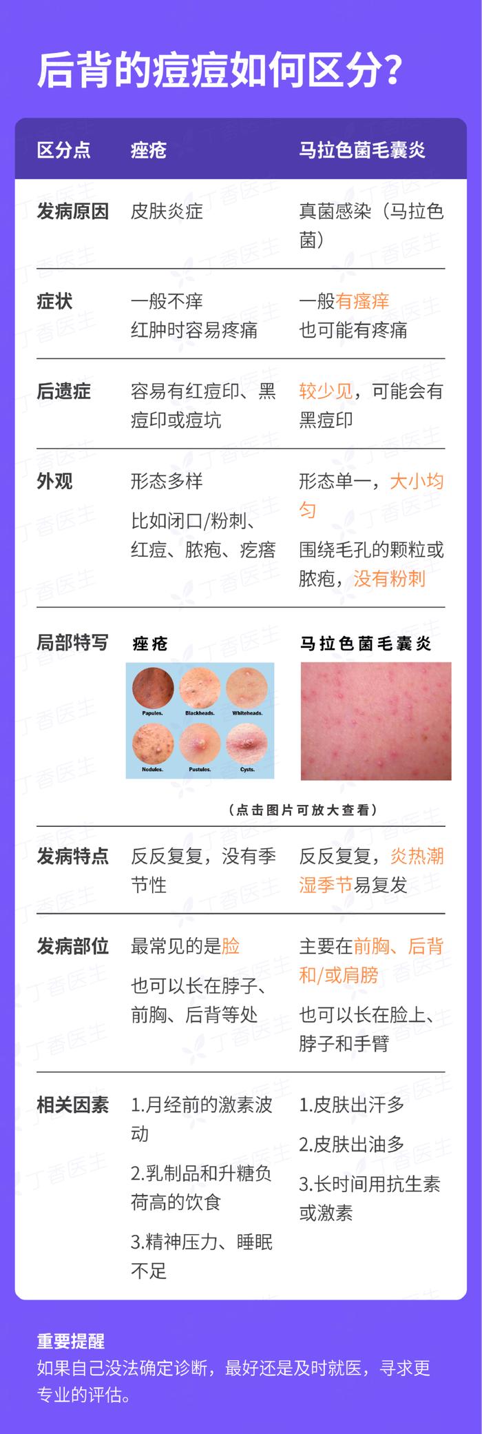 后背的痘痘消不掉，可能是方法用错了