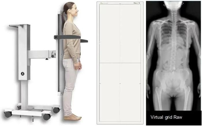 仅5秒！全脊柱、全下肢一次成像！无线、动态…超大120cm全幅长板探测器已上市！