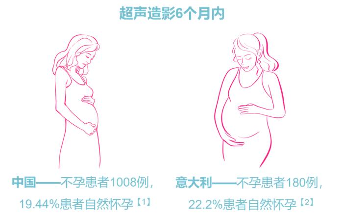 “不孕不育”新福音—子宫输卵管超声造影检查