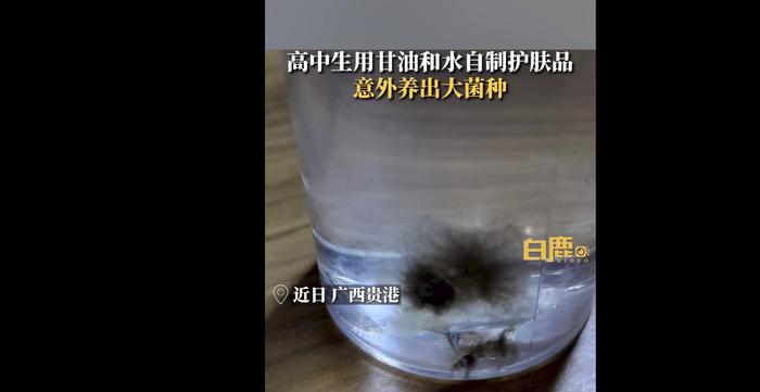 高中生用甘油自制护肤品养出大菌种，网友：菌只有在实验室养不出来