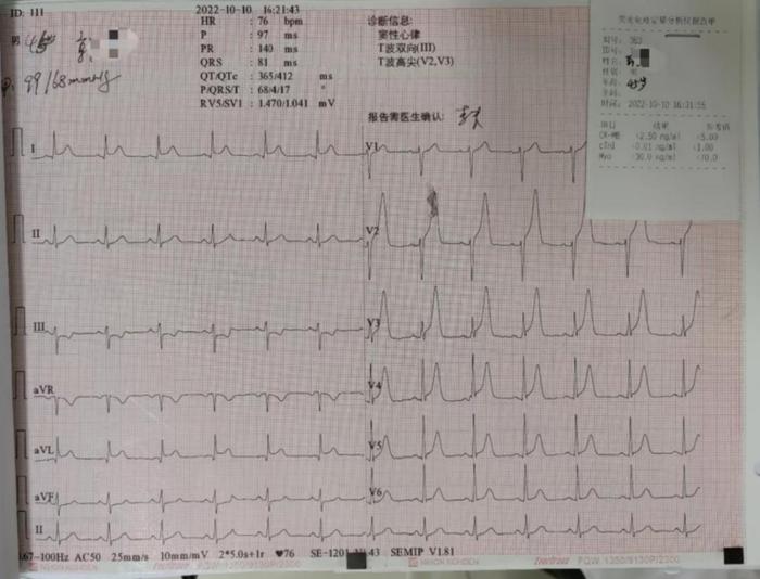 活心丸（浓缩丸）治疗病例之72—急性ST段抬高型前壁心肌梗死的男性患者