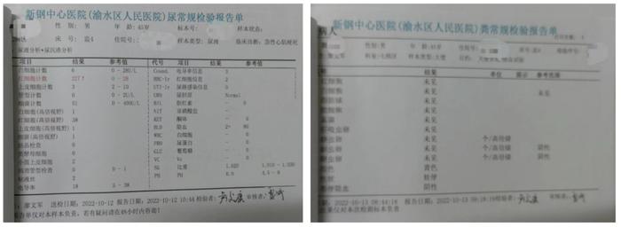 活心丸（浓缩丸）治疗病例之72—急性ST段抬高型前壁心肌梗死的男性患者