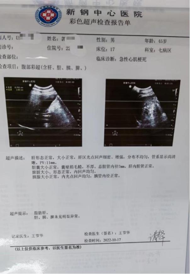 活心丸（浓缩丸）治疗病例之72—急性ST段抬高型前壁心肌梗死的男性患者