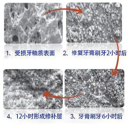 揭秘！ 80岁老牙医的护牙秘方，再也不补牙！