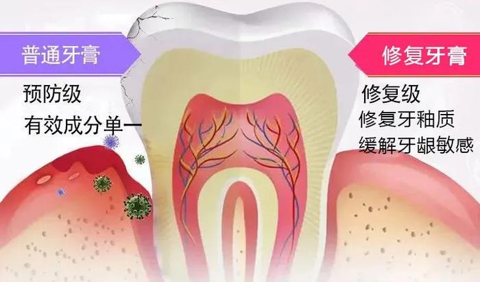 揭秘！ 80岁老牙医的护牙秘方，再也不补牙！