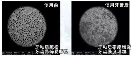 揭秘！ 80岁老牙医的护牙秘方，再也不补牙！