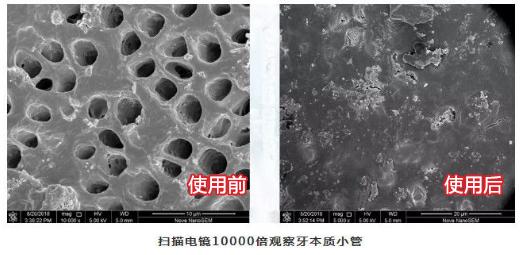 揭秘！ 80岁老牙医的护牙秘方，再也不补牙！