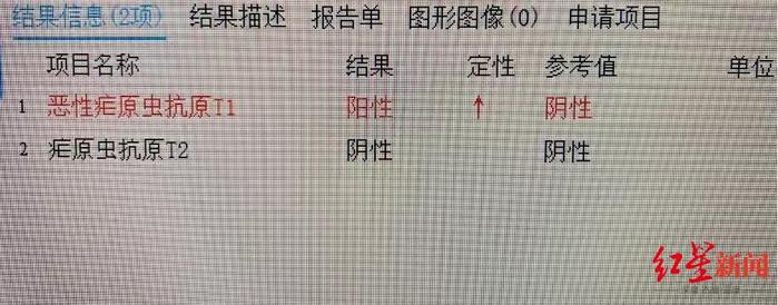 ▲检查提示恶性疟原虫抗原呈现阳性