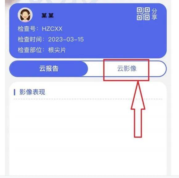 杭州口腔医院城西院区|公众号可以自助查询牙片啦