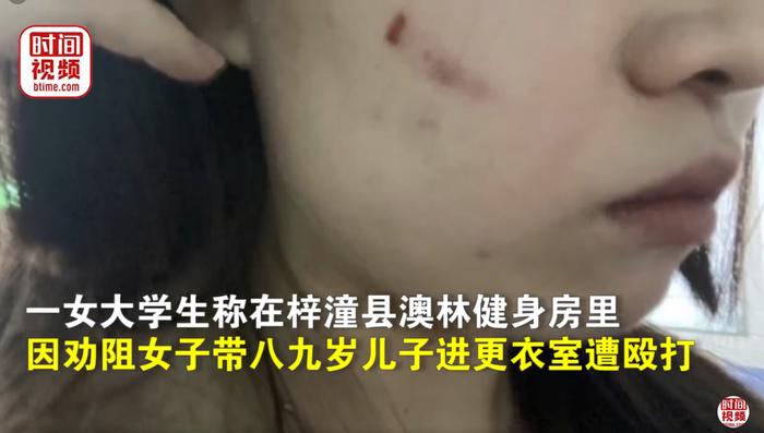 “她打伤了我，还管我要精神赔偿！”警方回应女生劝阻女子带男孩进更衣室遭打