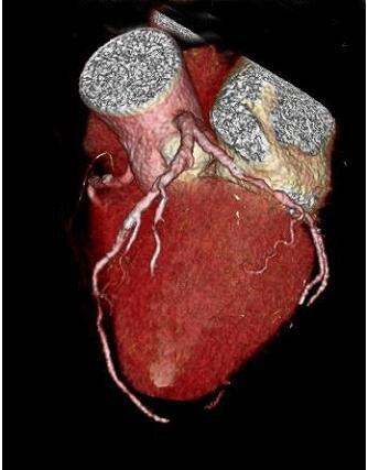 科普丨关于心脏的影像学检查，你了解多少？