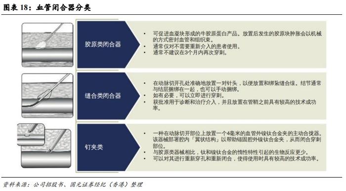 国元国际：予归创通桥-B(02190)“买入”评级 神经和外周血管介入龙头有望迎来快速增长