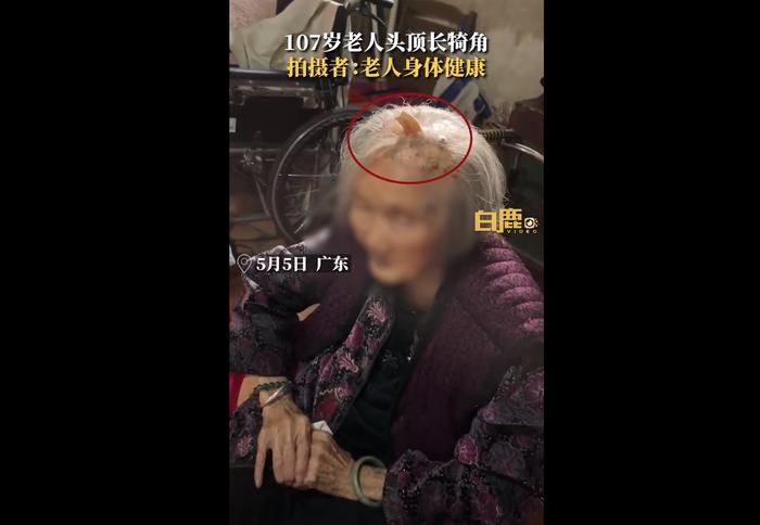 107岁老人头上长犄角，拍摄者：老人身体健康，网友：这是“长寿角”