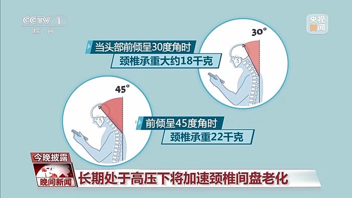 这些行为最伤颈椎，你中招了吗？如何正确预防和治疗颈椎病？