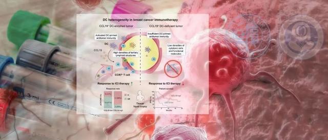 首次揭示“树突状细胞”关键作用，“复旦肿瘤”最毒乳腺癌治疗新“突”破