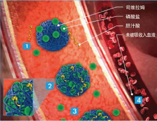 重磅来袭，百万高磷血症患者新希望