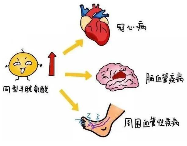 “同型半胱氨酸”是个什么指标？