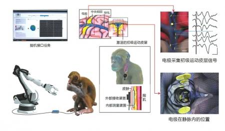 将“细绳”导入脑血管实现意念控制