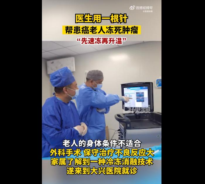 医生用一根针帮患癌老人冻死肿瘤：冷冻消融技术，先速冻再升温